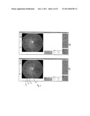 RETINAL IMAGE ANALYSIS SYSTEMS AND METHODS diagram and image