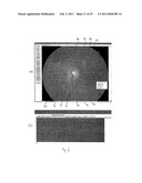 RETINAL IMAGE ANALYSIS SYSTEMS AND METHODS diagram and image