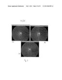 RETINAL IMAGE ANALYSIS SYSTEMS AND METHODS diagram and image