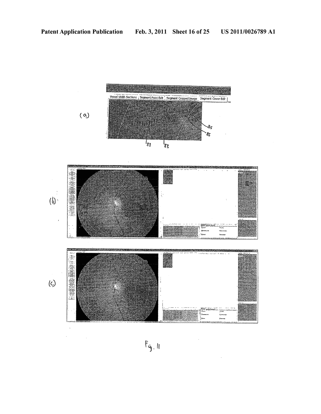 RETINAL IMAGE ANALYSIS SYSTEMS AND METHODS - diagram, schematic, and image 17