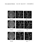 RETINAL IMAGE ANALYSIS SYSTEMS AND METHODS diagram and image