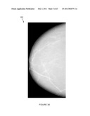 SYSTEMS, COMPUTER-READABLE MEDIA, AND METHODS FOR CLASSIFYING AND DISPLAYING BREAST DENSITY diagram and image