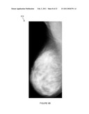 SYSTEMS, COMPUTER-READABLE MEDIA, AND METHODS FOR CLASSIFYING AND DISPLAYING BREAST DENSITY diagram and image