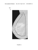 SYSTEMS, COMPUTER-READABLE MEDIA, AND METHODS FOR CLASSIFYING AND DISPLAYING BREAST DENSITY diagram and image