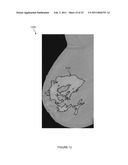 SYSTEMS, COMPUTER-READABLE MEDIA, AND METHODS FOR CLASSIFYING AND DISPLAYING BREAST DENSITY diagram and image