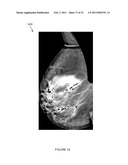 SYSTEMS, COMPUTER-READABLE MEDIA, AND METHODS FOR CLASSIFYING AND DISPLAYING BREAST DENSITY diagram and image