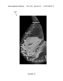 SYSTEMS, COMPUTER-READABLE MEDIA, AND METHODS FOR CLASSIFYING AND DISPLAYING BREAST DENSITY diagram and image