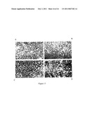 SUBSTANCE FOR OBTAINING HIGHLY EFFECTIVE TUMOR MEDICATIONS AS WELL AS A PROCESS diagram and image