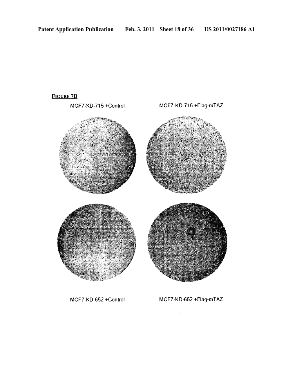 TAZ/WWTR1 FOR DIAGNOSIS AND TREATMENT OF CANCER - diagram, schematic, and image 19