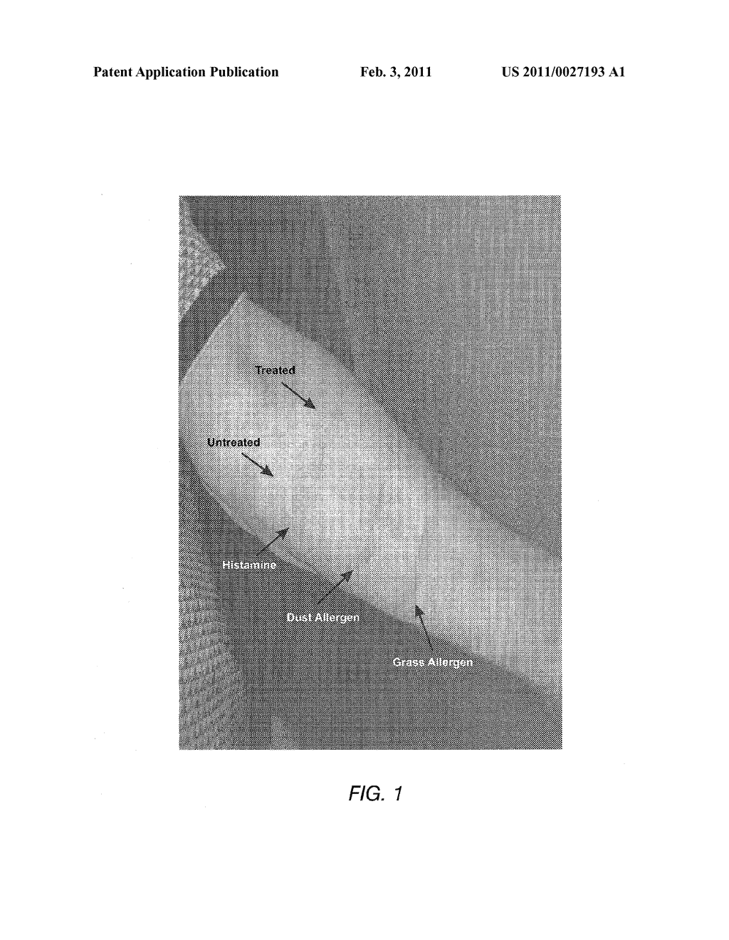 COMPOSITIONS AND METHODS FOR THE TREATMENT OF INFLAMMATORY CONDITIONS - diagram, schematic, and image 02