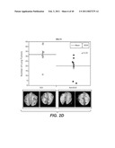 INHIBITION OF TUMOR METASTASIS diagram and image