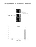 INHIBITION OF TUMOR METASTASIS diagram and image