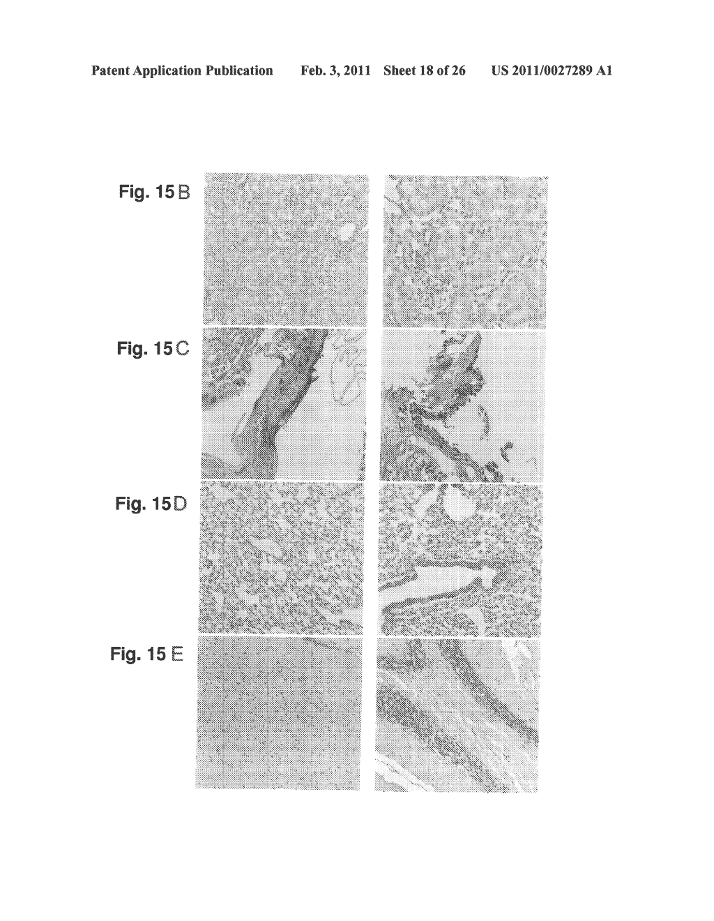 METHOD FOR TREATING SYNOVIAL SARCOMA - diagram, schematic, and image 19