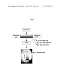 DEVICE FOR IN SITU PRODUCTION AND TOPICAL ADMINISTRATION OF ALLICIN diagram and image