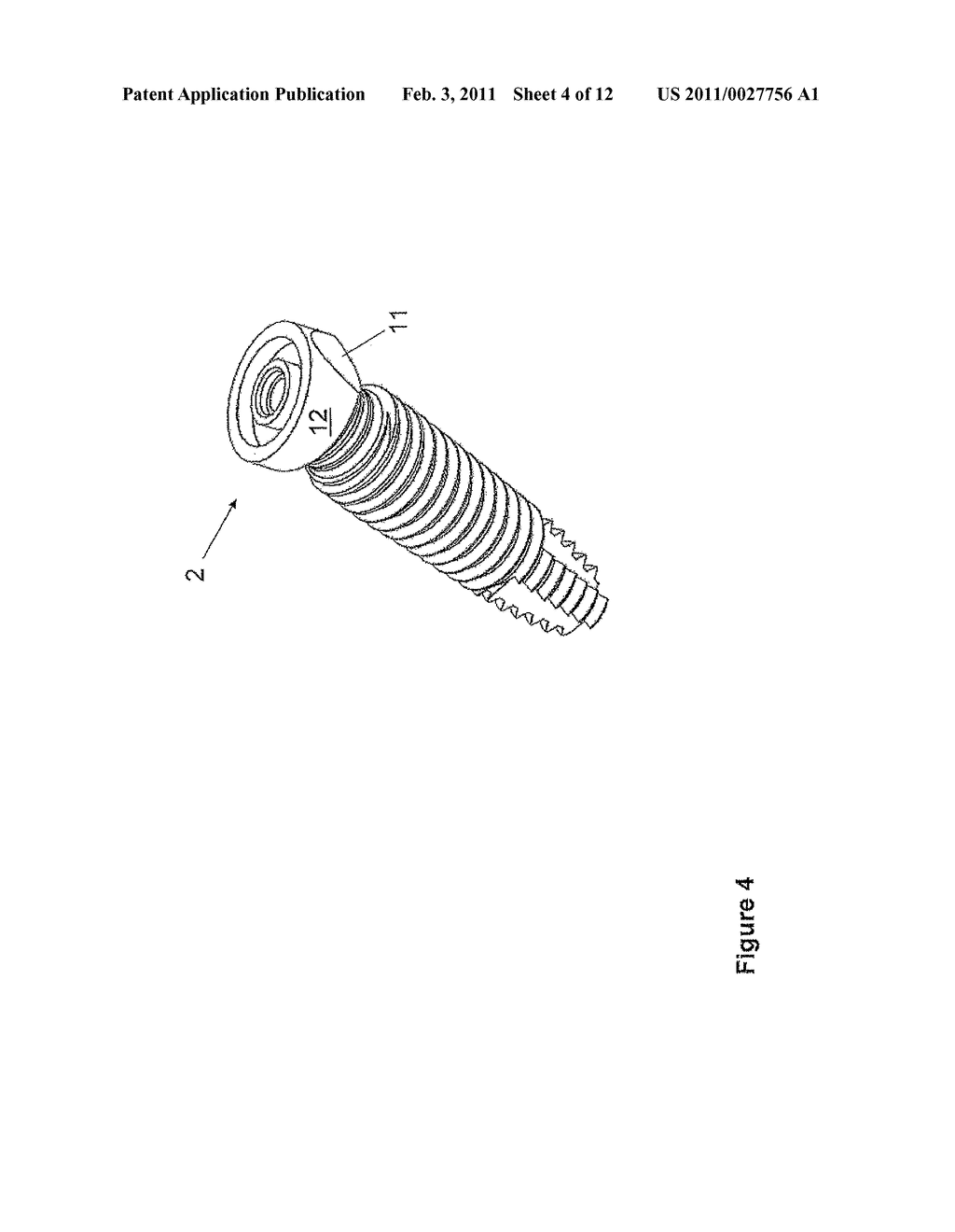 ONE-PIECE INCLINED DENTAL IMPLANT - diagram, schematic, and image 05