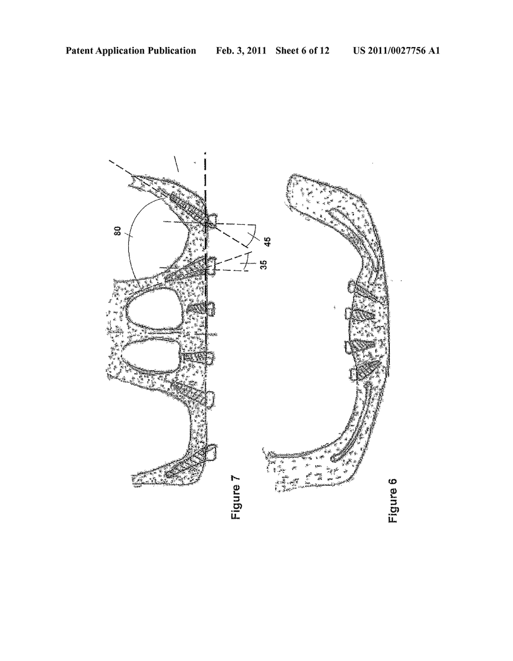 ONE-PIECE INCLINED DENTAL IMPLANT - diagram, schematic, and image 07