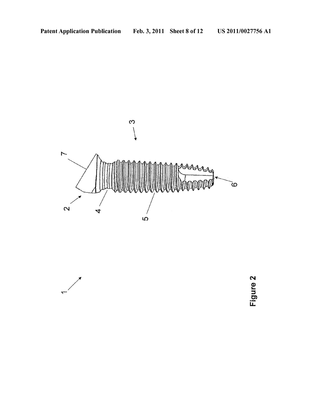 ONE-PIECE INCLINED DENTAL IMPLANT - diagram, schematic, and image 09