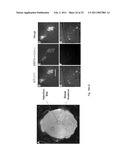 EphA KINASE CANCER DIAGNOSTIC diagram and image