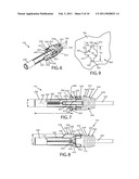 Cable Connector Apparatus diagram and image