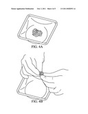 FLOWABLE PASTE AND PUTTY BONE VOID FILLER diagram and image