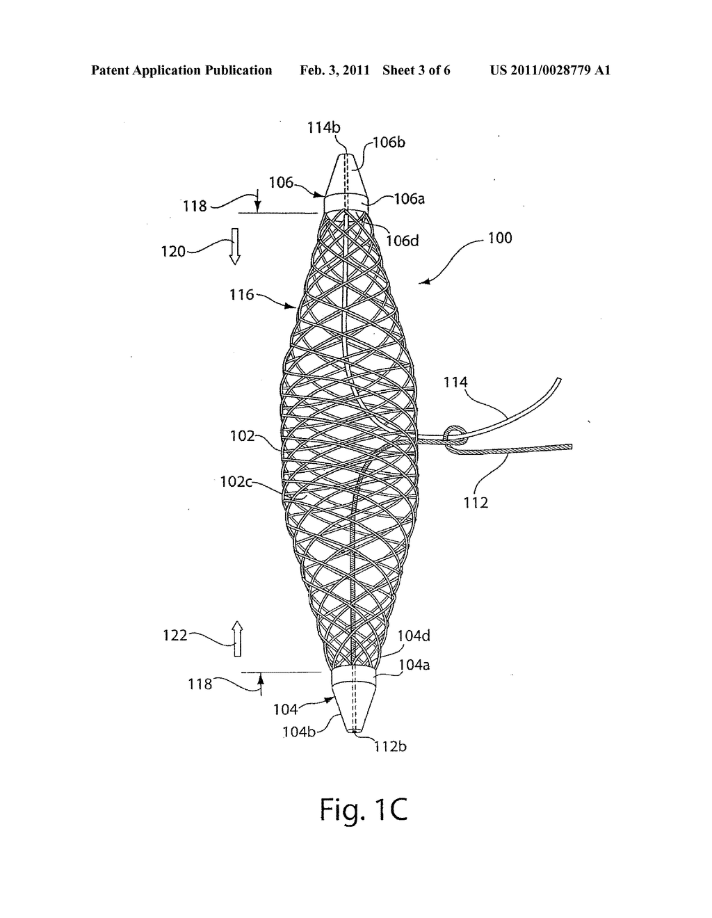 TUBULAR IMPLANTABLE SLING AND RELATED DELIVERY SYSTEMS, METHODS AND DEVICES - diagram, schematic, and image 04