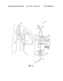 Non-Contact Infrared Fiber-Optic Device for Monitoring Esophageal Temperature to Prevent Thermal Injury During Radiofrequency Catheter Ablation or Cryoablation diagram and image