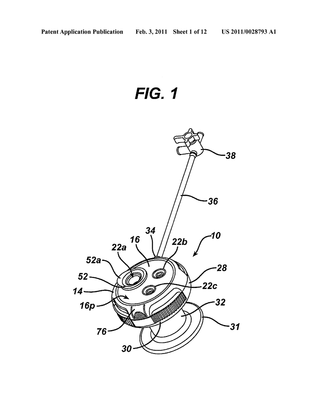 METHODS AND DEVICES FOR PROVIDING ACCESS INTO A BODY CAVITY - diagram, schematic, and image 02