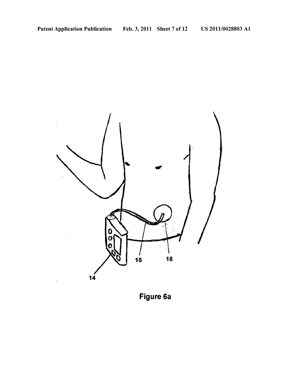 METHOD AND DEVICE FOR NON-INVASIVE DETERMINATION OF THE CONCENTRATION OF A SUBSTANCE IN A BODY FLUID - diagram, schematic, and image 08