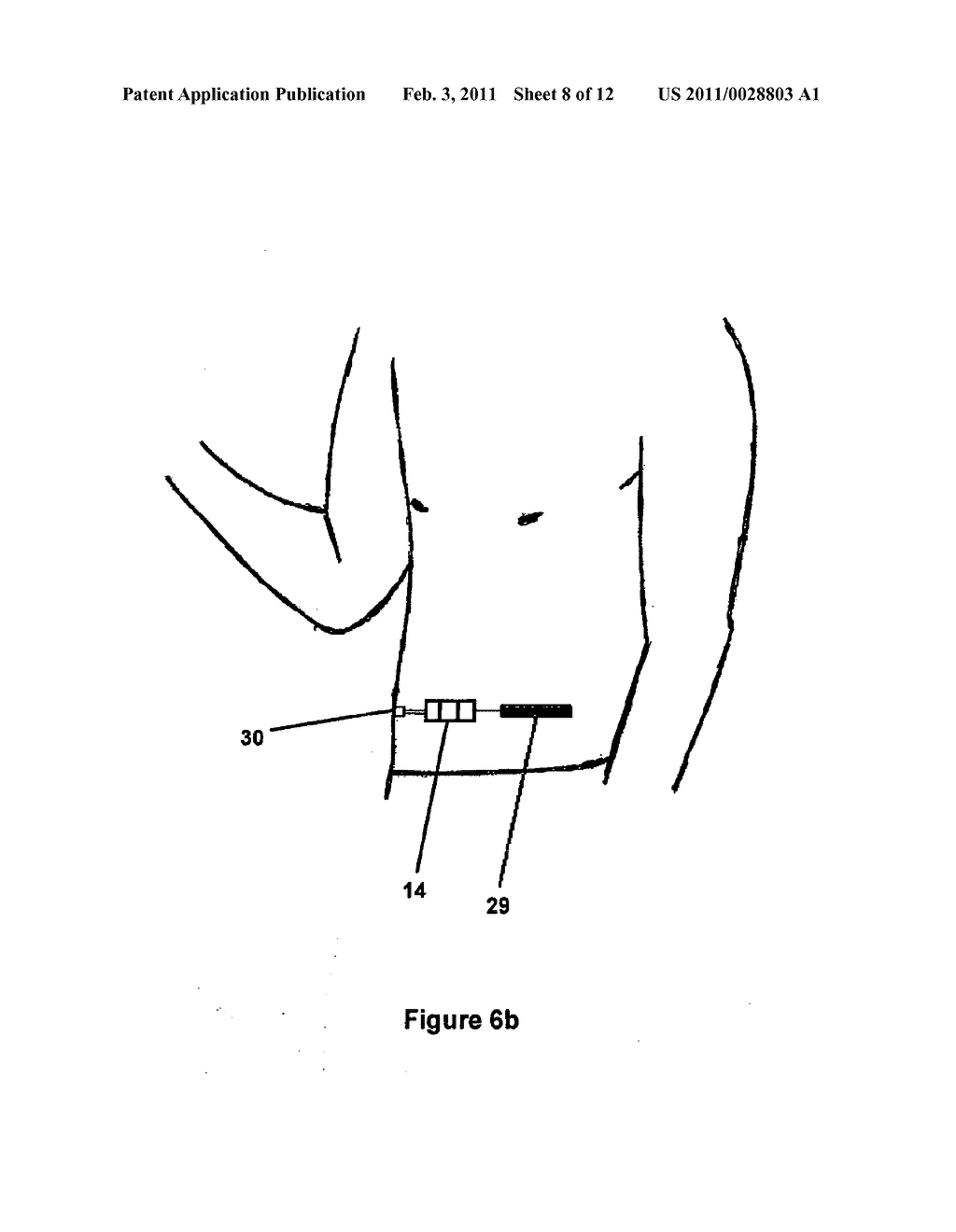 METHOD AND DEVICE FOR NON-INVASIVE DETERMINATION OF THE CONCENTRATION OF A SUBSTANCE IN A BODY FLUID - diagram, schematic, and image 09