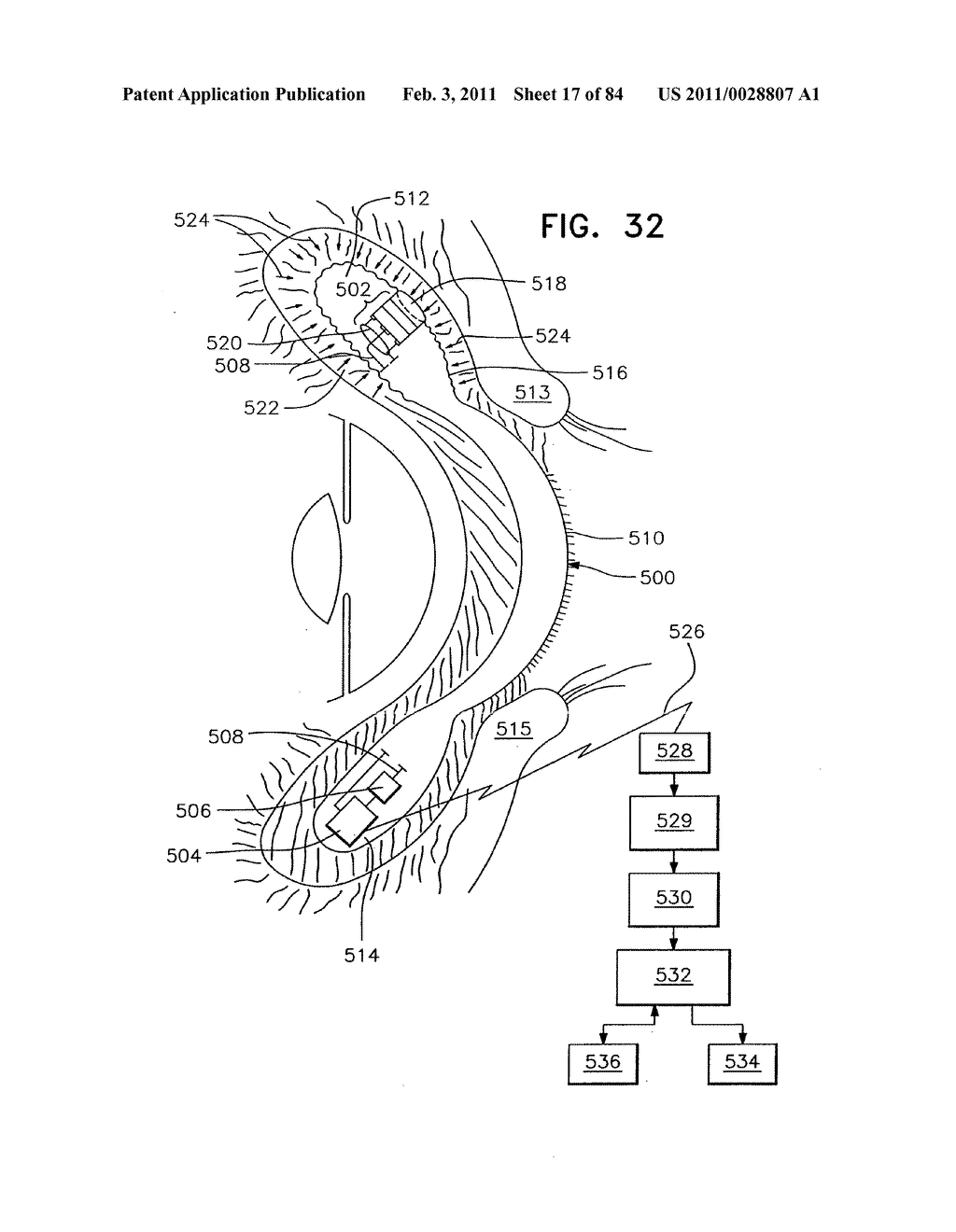 Contact lens for collecting tears and detecting at least one analyte - diagram, schematic, and image 18