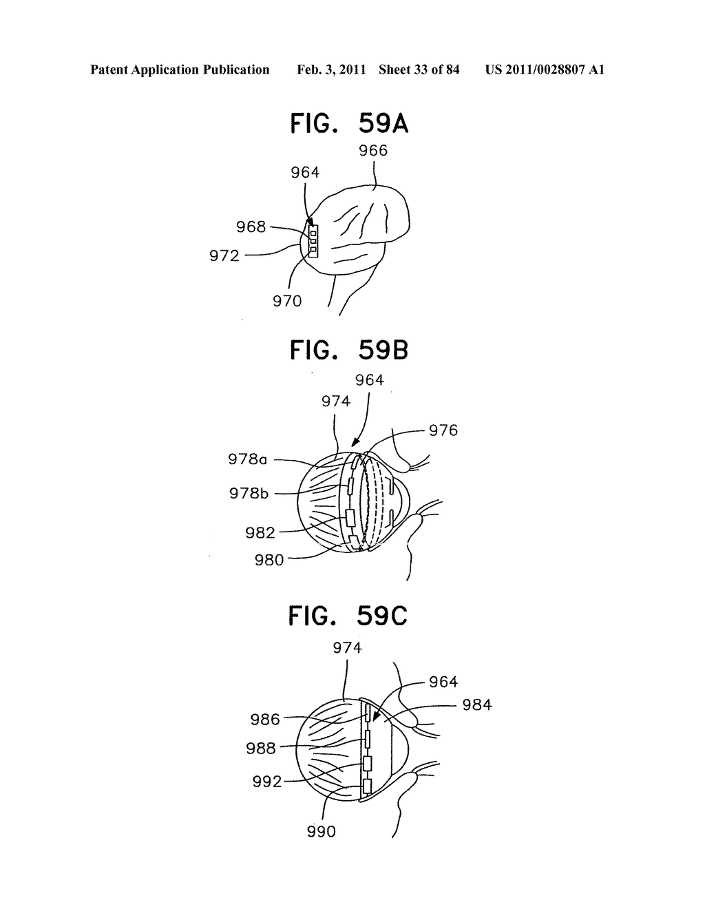 Contact lens for collecting tears and detecting at least one analyte - diagram, schematic, and image 34