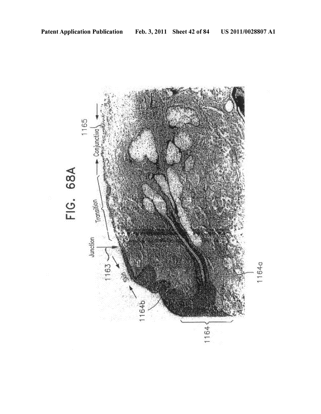 Contact lens for collecting tears and detecting at least one analyte - diagram, schematic, and image 43