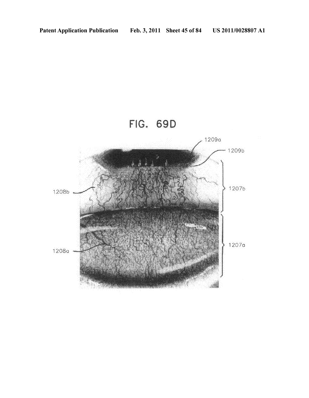 Contact lens for collecting tears and detecting at least one analyte - diagram, schematic, and image 46