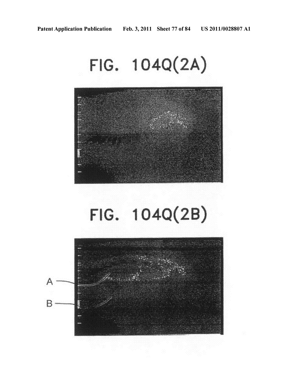 Contact lens for collecting tears and detecting at least one analyte - diagram, schematic, and image 78