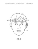 Medical Monitoring Patch Device And Methods diagram and image