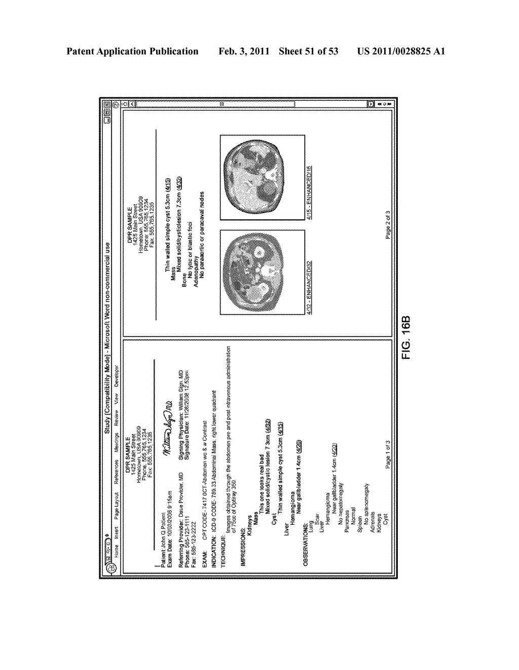 SYSTEMS AND METHODS FOR EFFICIENT IMAGING - diagram, schematic, and image 52