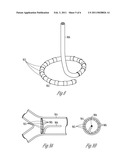 MAPPING PROBE ASSEMBLY WITH SKIVED TUBE BODY FRAME diagram and image