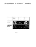 SPATIOTEMPORAL PATTERN CLASSIFICATION OF BRAIN STATES diagram and image