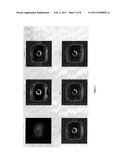 T1 RHO MAGNETIC RESONANCE IMAGING FOR STAGING OF HEPATIC FIBROSIS diagram and image