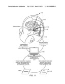 Methods, Systems and Devices for Monitoring a Target in a Neural System and Facilitating or Controlling a Cell Therapy diagram and image