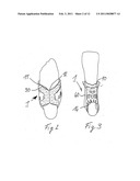 ORTHOTIC SYSTEM FOR AN ANKLE JOINT diagram and image