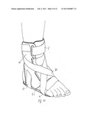 ORTHOTIC SYSTEM FOR AN ANKLE JOINT diagram and image