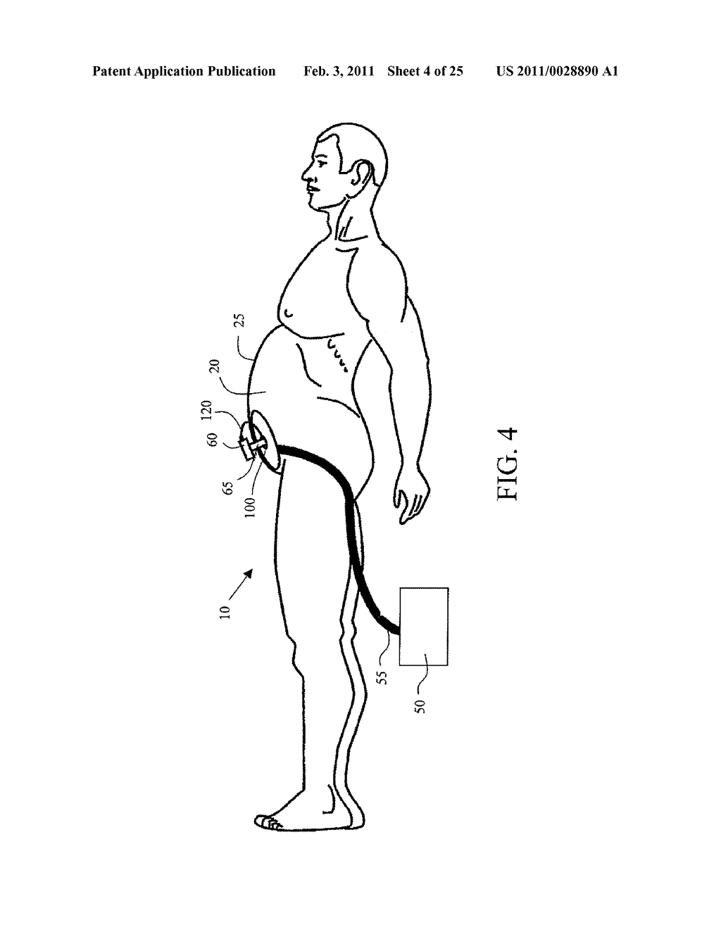 INSUFFLATION GAS WARMER AND HUMIDIFIER - diagram, schematic, and image 05