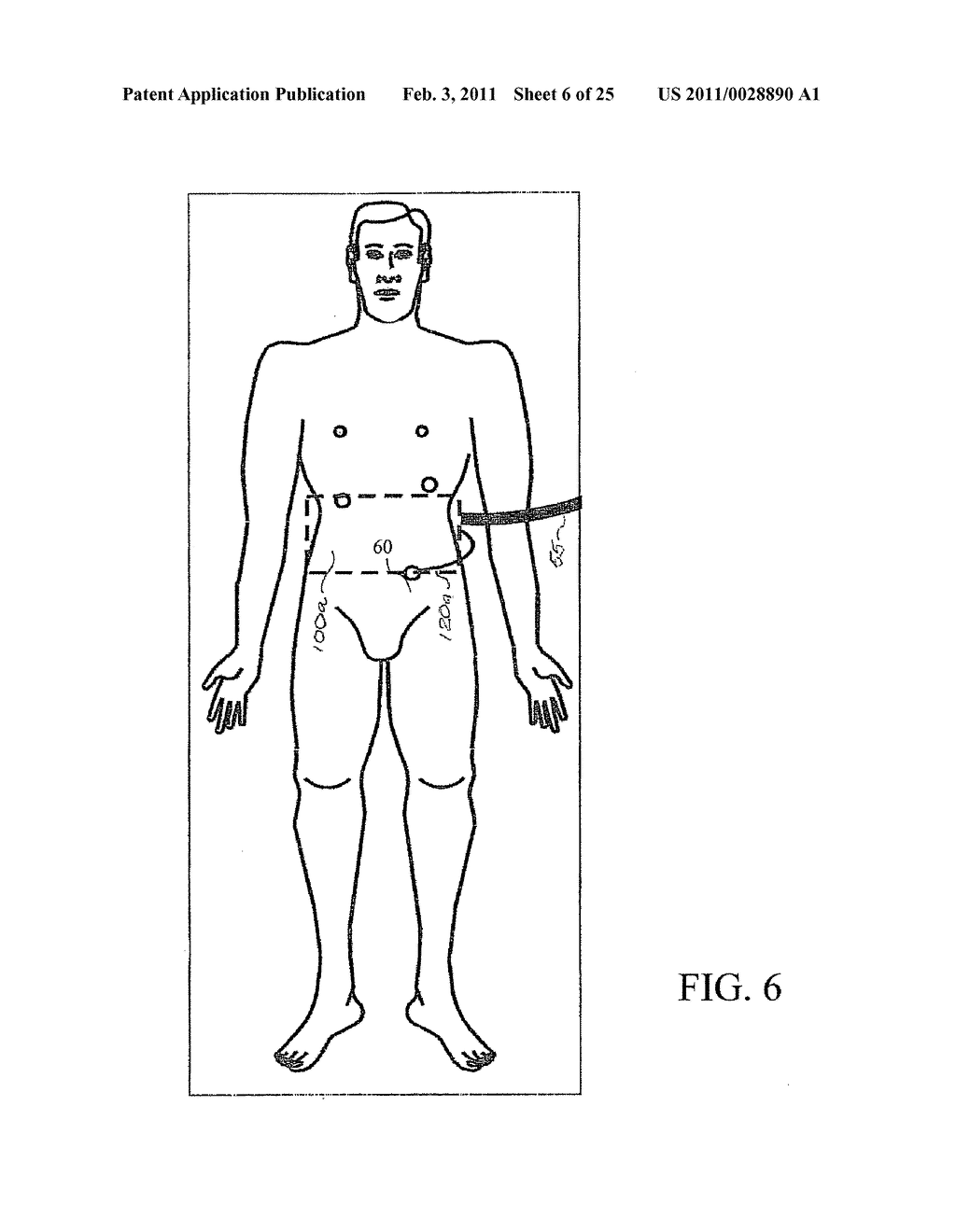 INSUFFLATION GAS WARMER AND HUMIDIFIER - diagram, schematic, and image 07