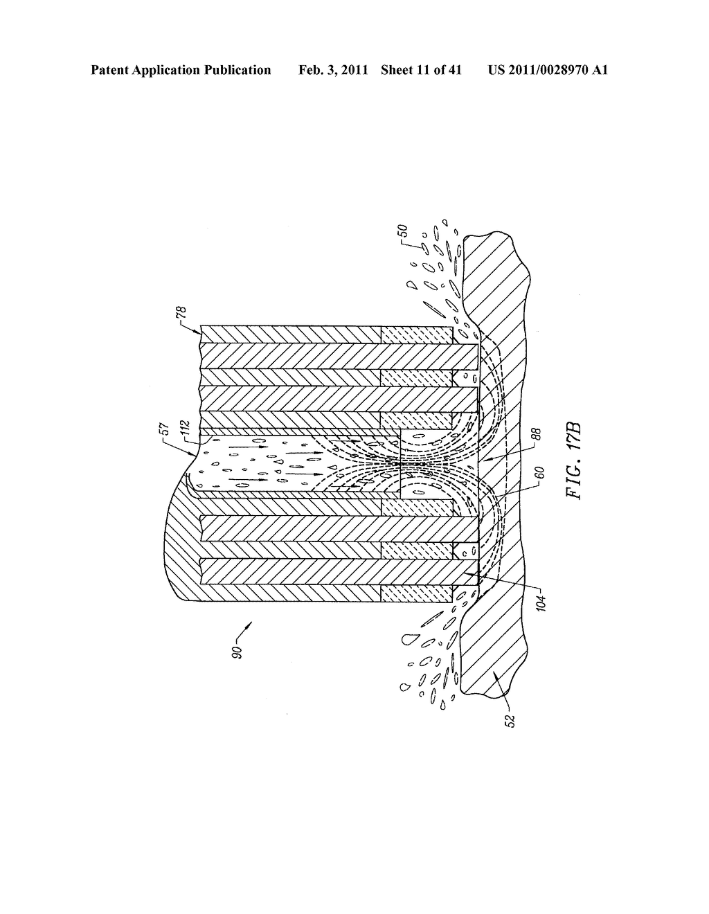 ELECTROSURGICAL SYSTEMS AND METHODS FOR REMOVING AND MODIFYING TISSUE - diagram, schematic, and image 12