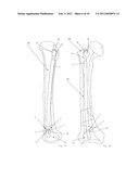 DEVICE FOR REDUCING A BONE FRACTURE diagram and image