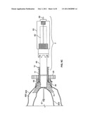 CONDUIT DEVICE AND SYSTEM FOR IMPLANTING A CONDUIT DEVICE IN A TISSUE WALL diagram and image