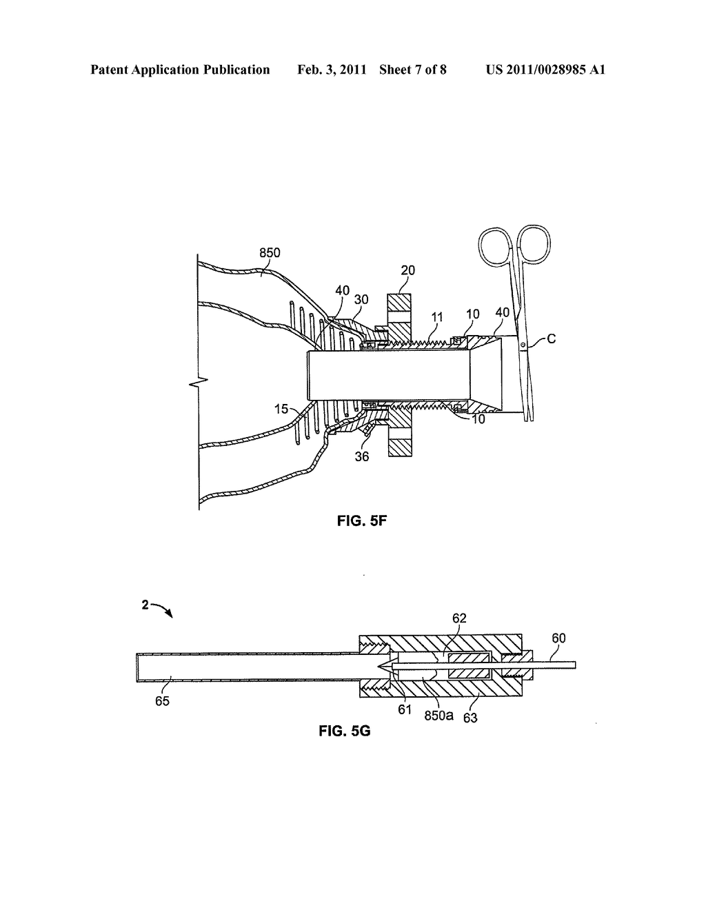 CONDUIT DEVICE AND SYSTEM FOR IMPLANTING A CONDUIT DEVICE IN A TISSUE WALL - diagram, schematic, and image 08