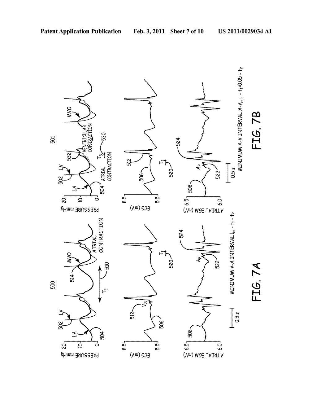 ALGORITHM TO MODULATE ATRIAL-VENTRICULAR DELAY AND RATE RESPONSE BASED ON AUTONOMIC FUNCTION - diagram, schematic, and image 08