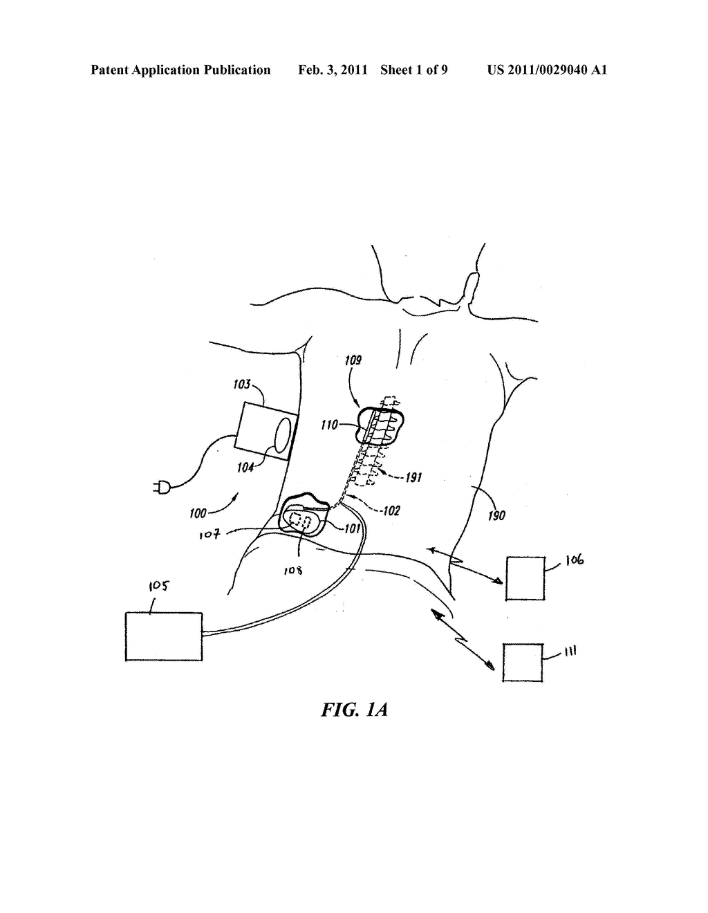 LINKED AREA PARAMETER ADJUSTMENT FOR SPINAL CORD STIMULATION AND ASSOCIATED SYSTEMS AND METHODS - diagram, schematic, and image 02